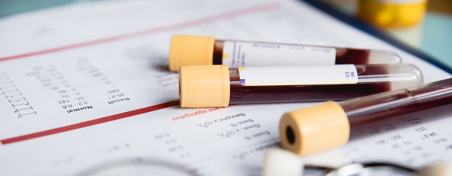 Blood Vials